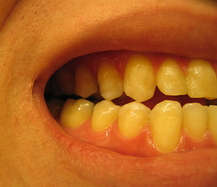 images/zeby.JPG0c72e.JPG
